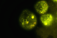 /album/protozoi/vorticella-2-gif/